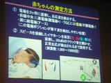新生児聴覚スクリーニング検査について①