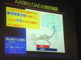 新生児聴覚スクリーニング検査について①