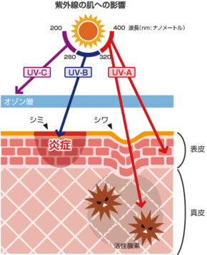 紫外線→光老化
