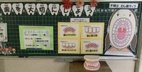 歯科検診がありました