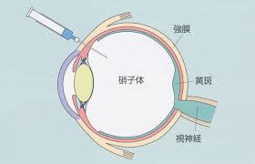 濃いめの注射液で・・