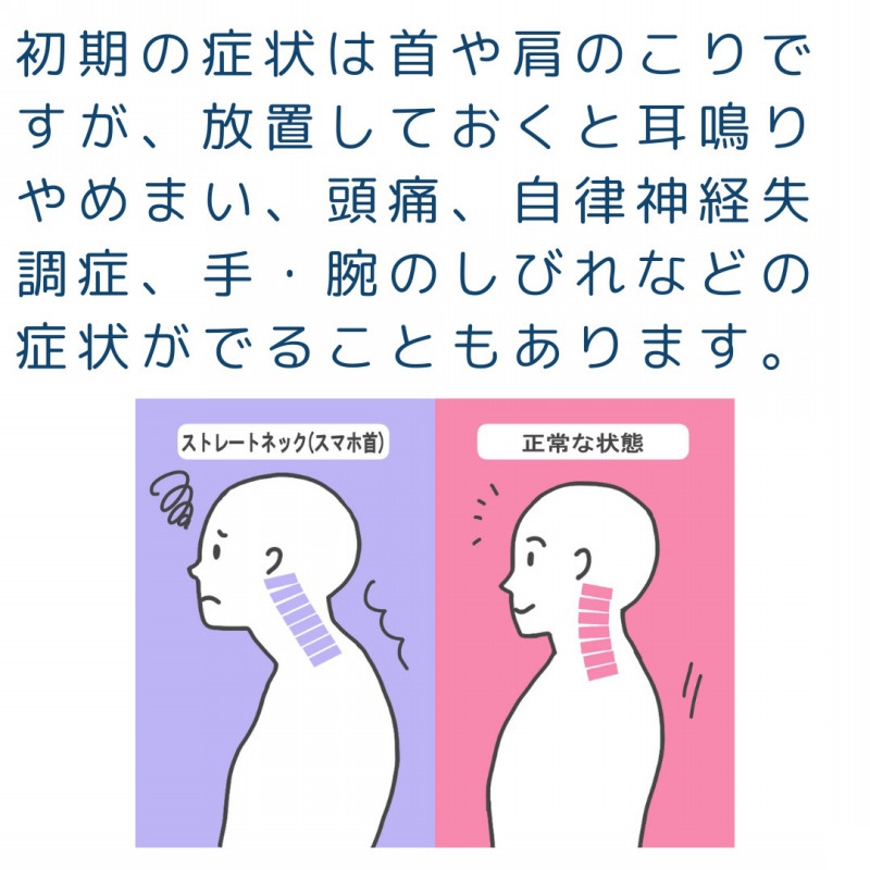 スマホ首とは？？